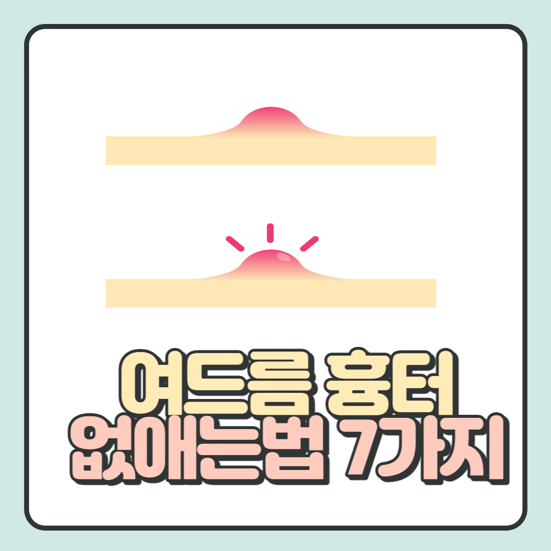 여드름-흉터-없애는-법