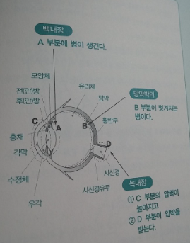 안과 질환