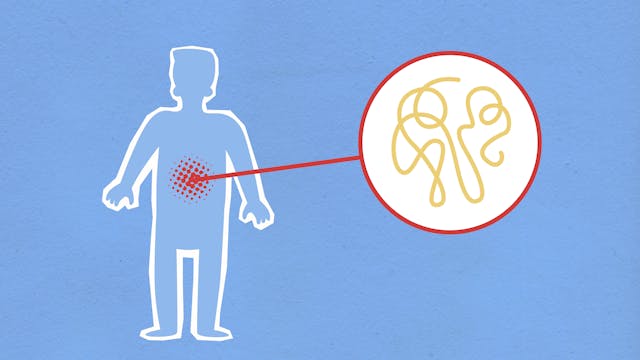 패혈증 원인, 증상, 예방법 관련 이미지
