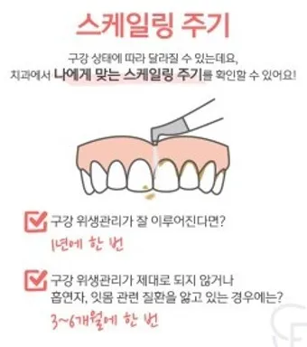 스케일링 후 양치 통증 음식_14