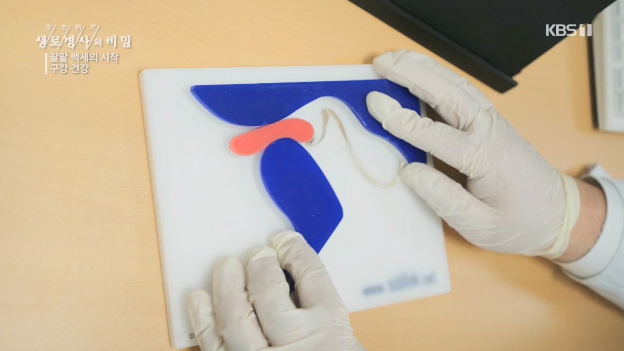 생로병사의 비밀.E894.240118p.H264-F1RST.mp4_20240118_195351.832.jpg