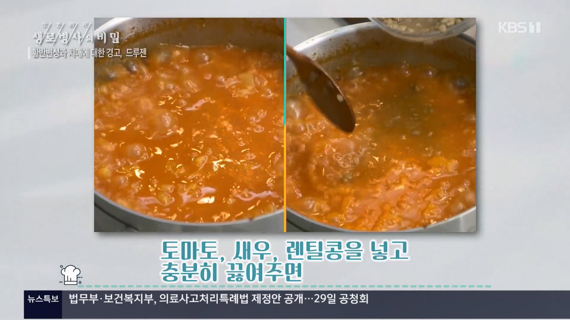 생로병사의 비밀.E899.240228p.H264-F1RST.mp4_20240229_202220.366.jpg