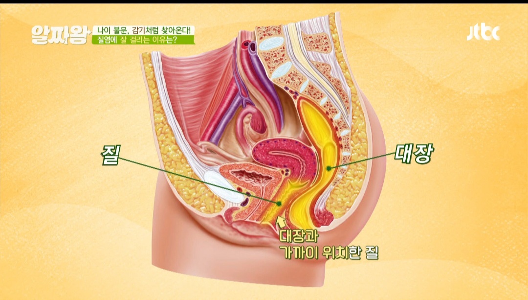  질 건강 유산균 리스펙타 효능 부작용 / 질염 원인 예방