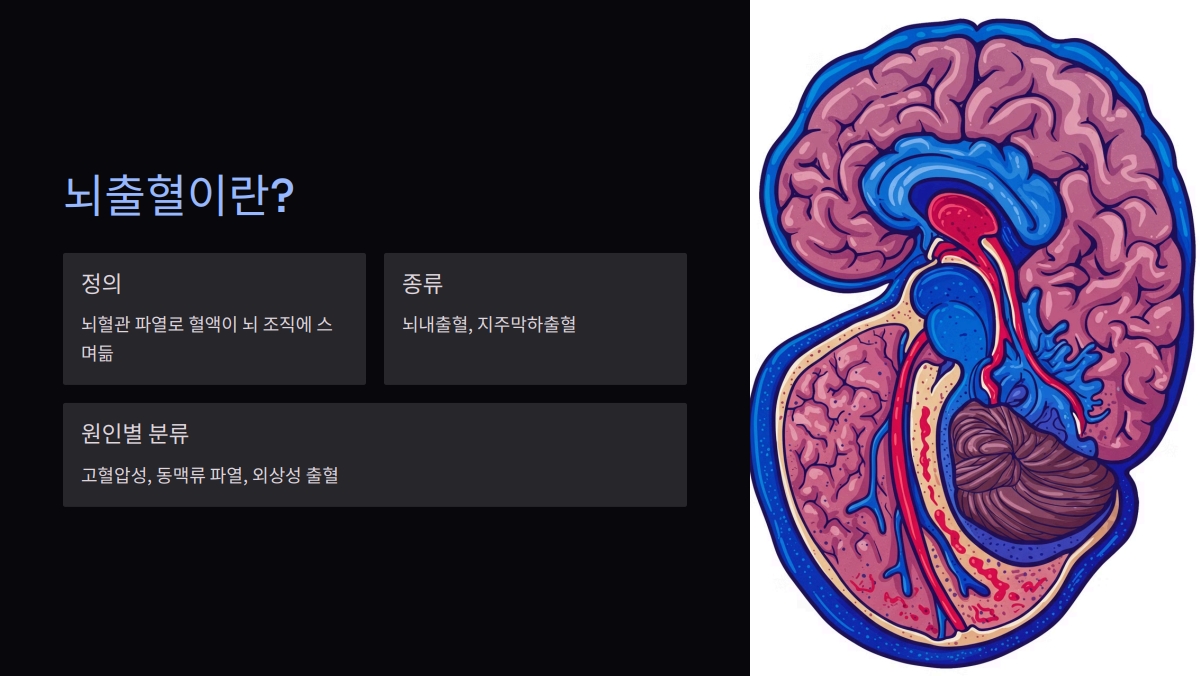 뇌출혈 자가 진단