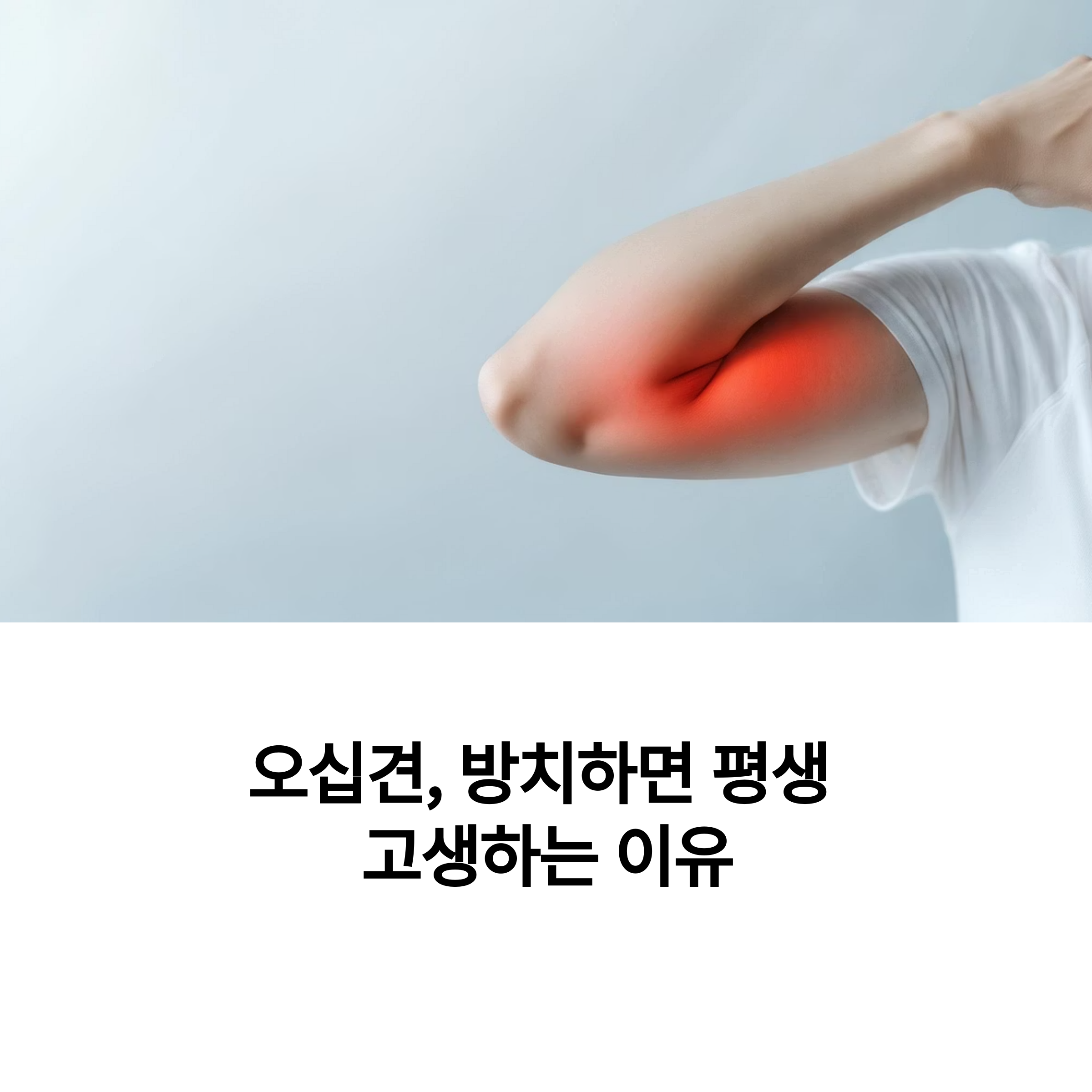 오십견