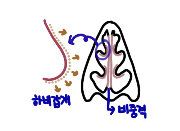 하비갑개-비중격-모형-사진