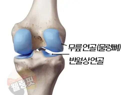 무릎은-크게-무릎연골과-반월상연골-무릎뼈로-구성되어-있습니다.