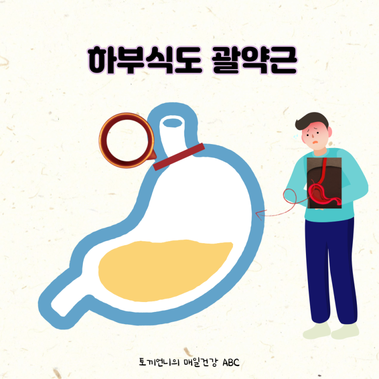 역류성 식도염증상기해의 원인 치료방법 3