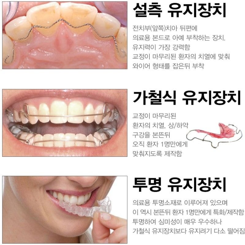  치아교정 후 관리