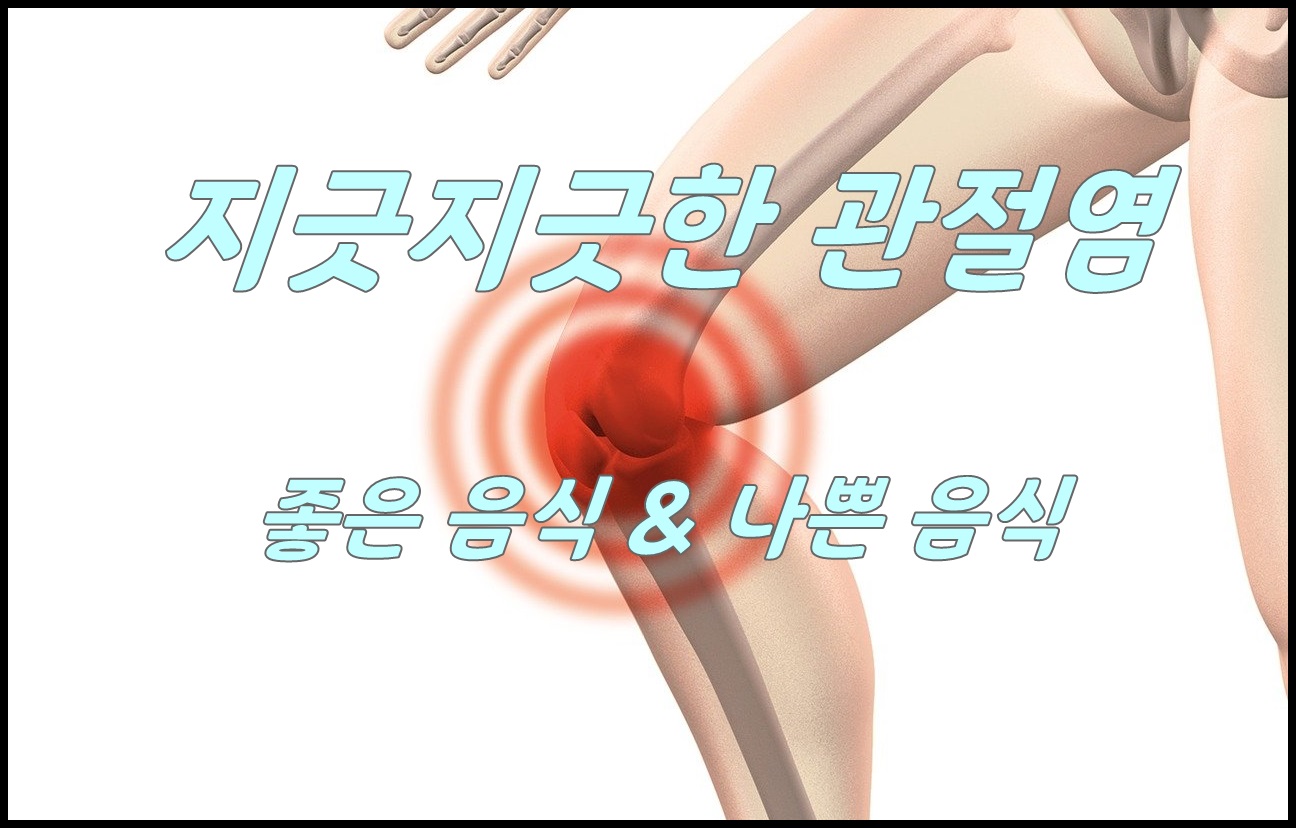  관절염 좋은 음식 류마티스관절염과 퇴행성관절염 차이