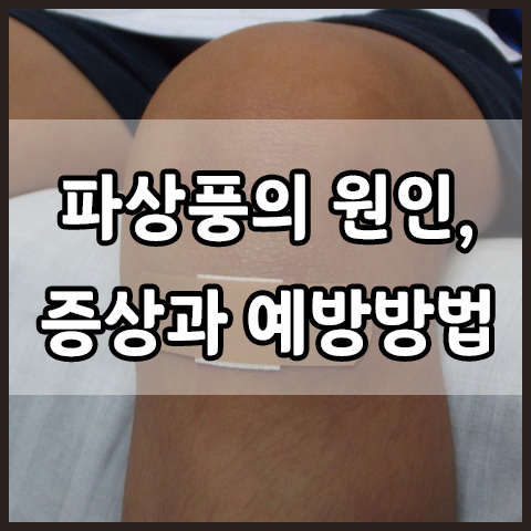  파상풍의 원인, 증상과 예방 방법