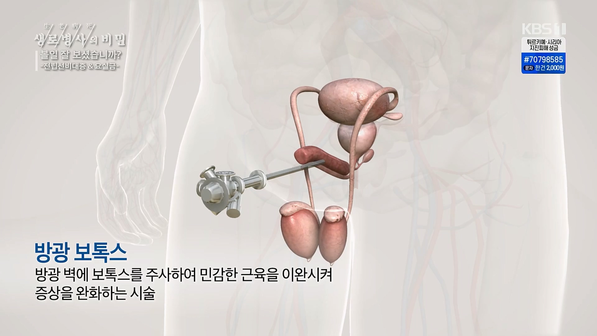 생로병사의 비밀.E856.230215p.H264-F1RST.mp4_20230216_195523.887.jpg