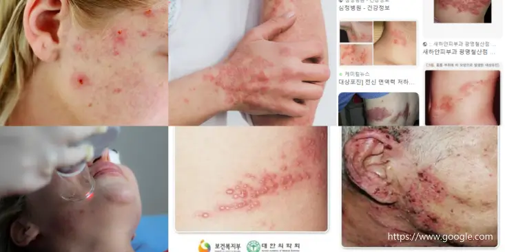 대전 중구 피부과 주근깨, 잡티는 어떻게 해결할까? 없애고 싶다면 꼭 읽어야 할 글