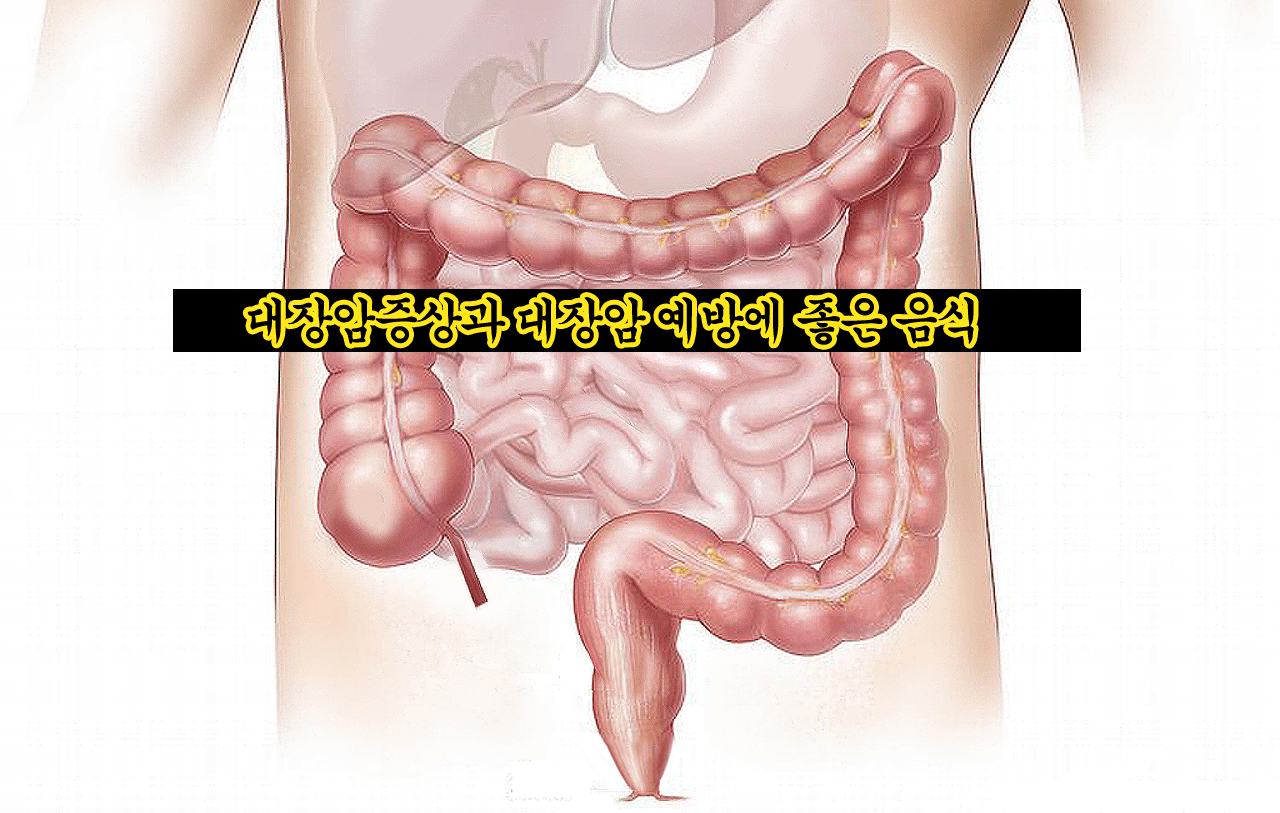  대장암증상과 대장암 예방에 좋은 음식