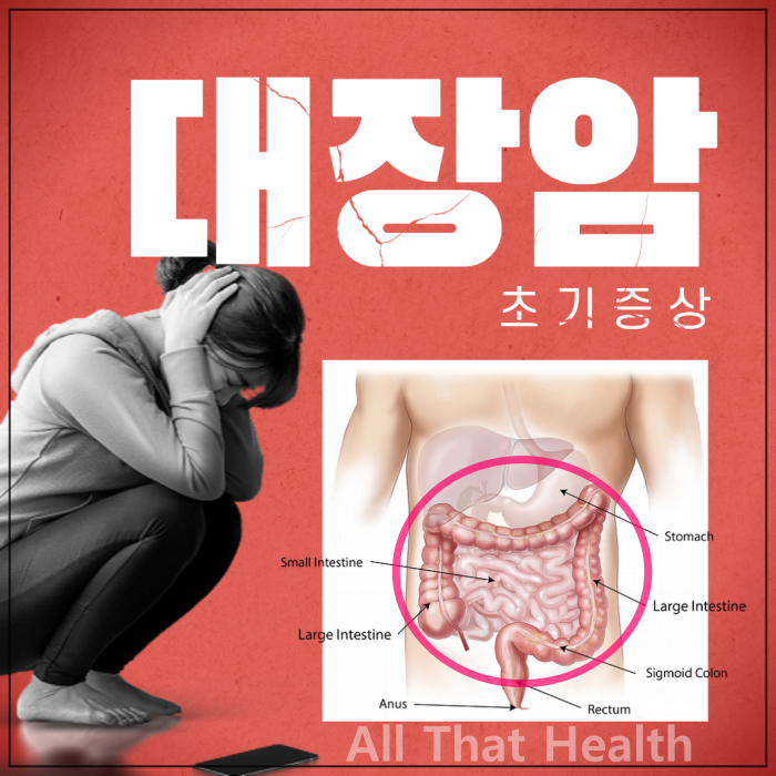 대장암