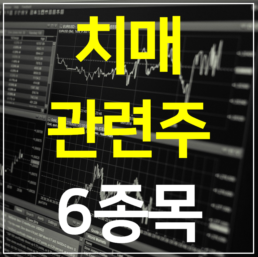  치매 관련주 6종목 (치료제 알츠하이머 신약)