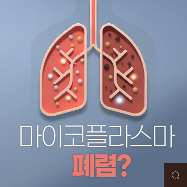 마이코플라스마 폐렴