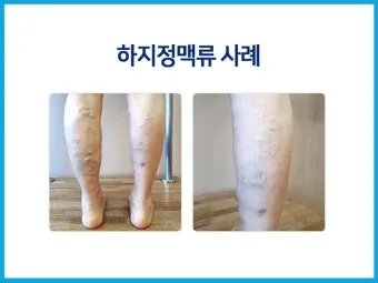 하지 날짜 24절기 망종 소서 전통음식까지_13