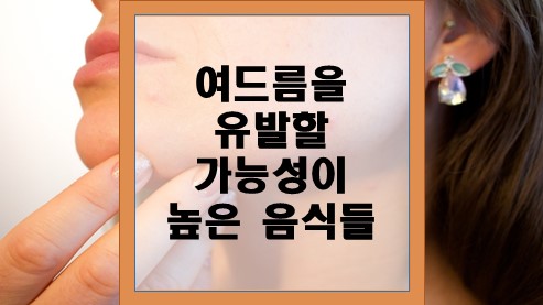 여드름을-유발할-가능성이-높은-음식들