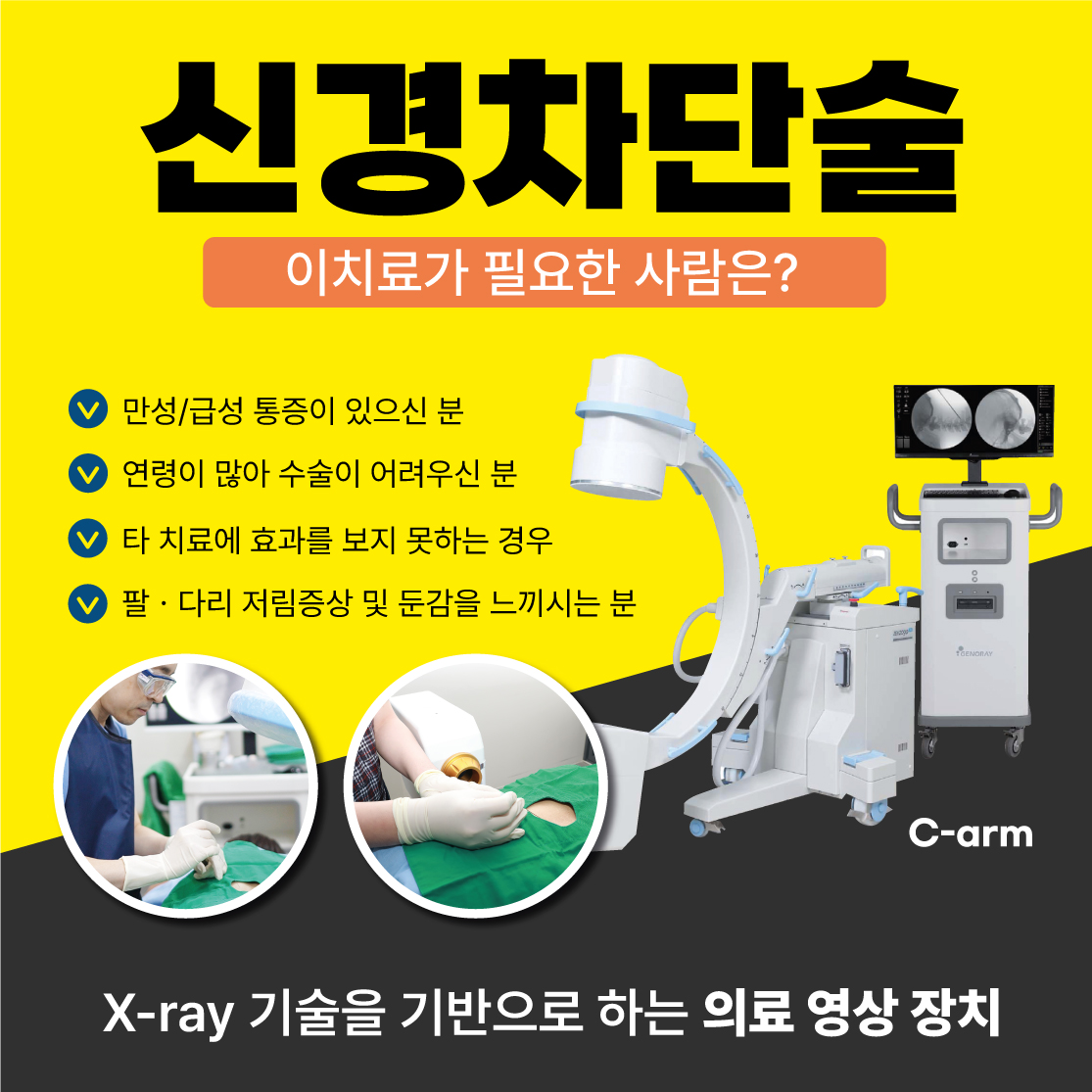  연신내역정형외과, 심한 허리 통증 완화를 위한 신경차단술