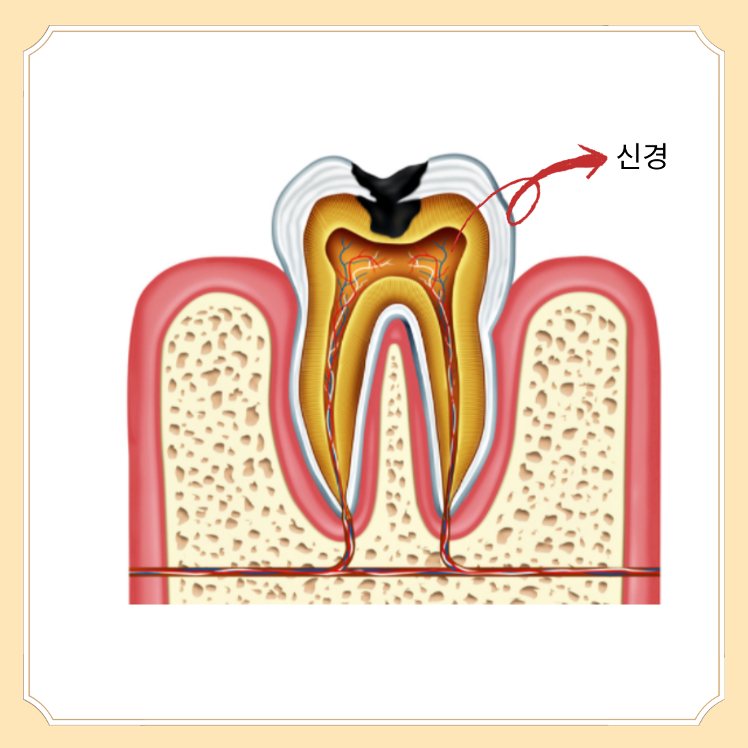 치아-구조