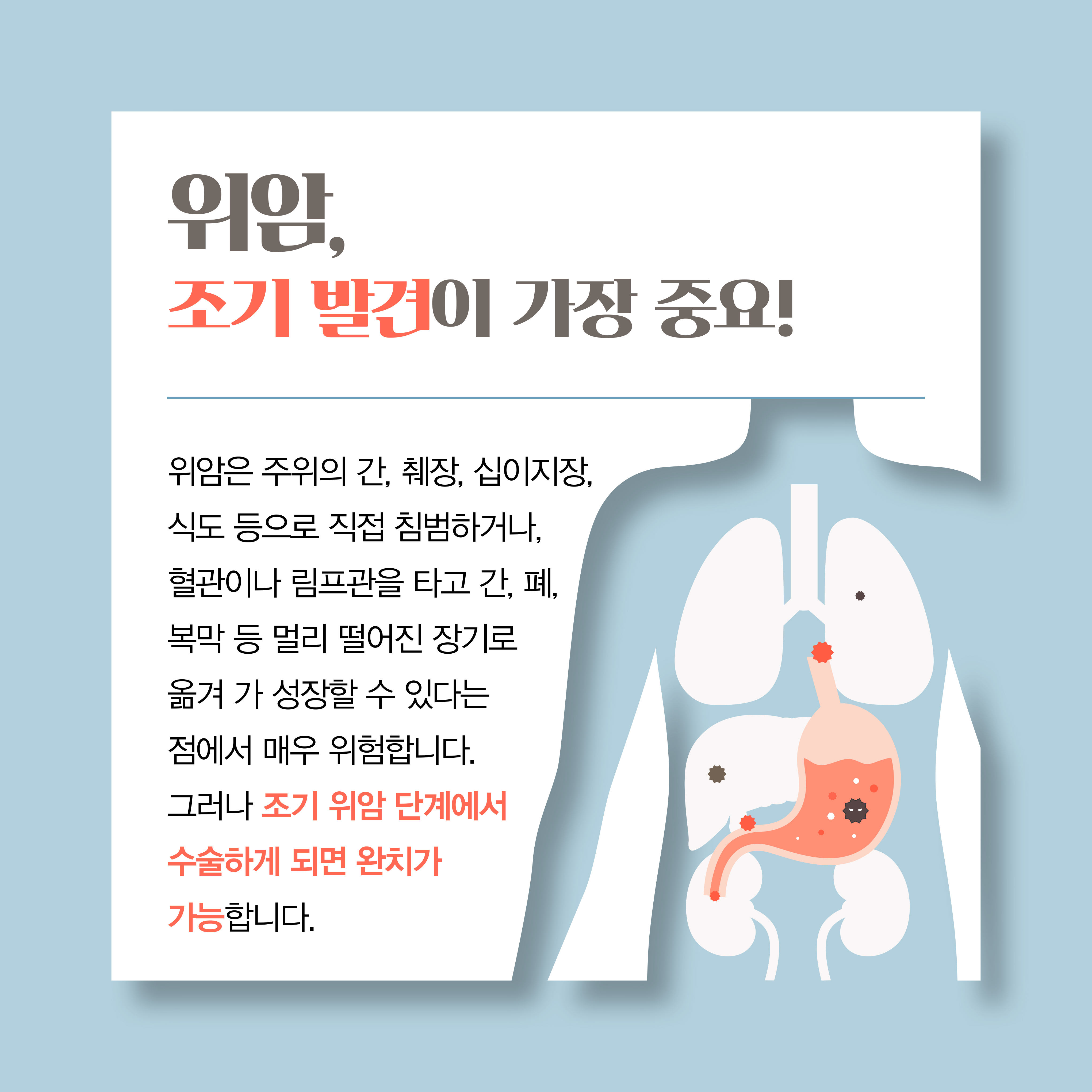 위암