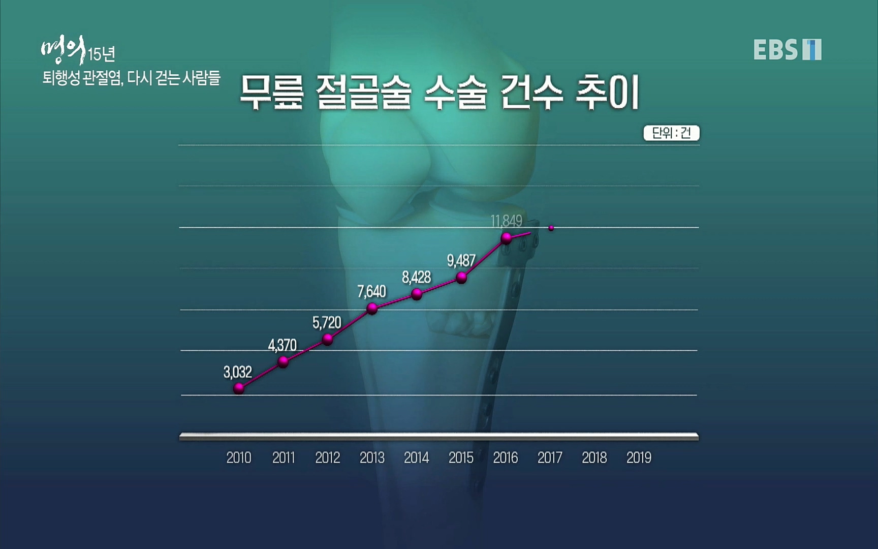 EBS 명의 헬스케어 - TV - 교육의 중심 EBS명의 15년 - 퇴행성관절염, 다시 걷는 사람들.mp4_20220803_212705.688.jpg