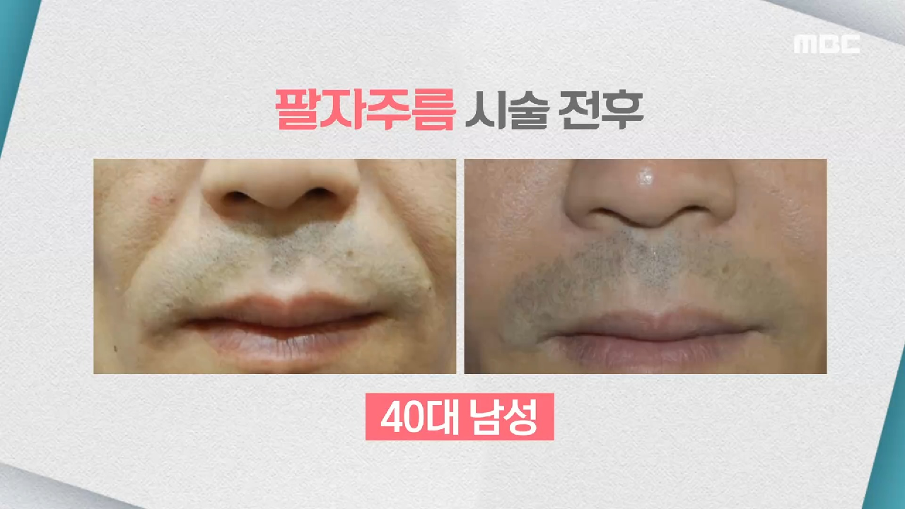  기분 좋은 날 동안 비법 피부 주름 자양강장제 마사지 저분자 콜라겐 펩타이드 명태껍질 탈모 예방 어성초 스프레이 화장솜 쿨링팩 보톡스 필러 신체 나이 자가 진단