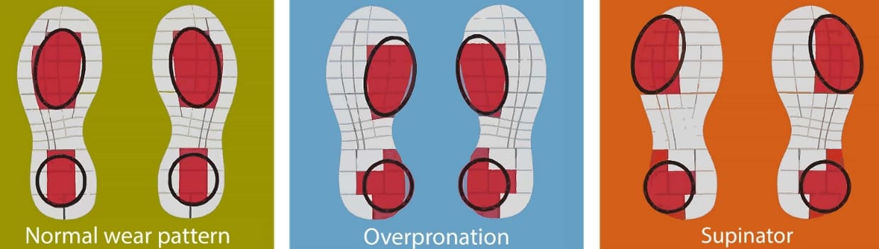  '신발 밑창' 보면 척추·골반 건강 상태 알 수 있다 What are the bottoms of your shoes telling you?
