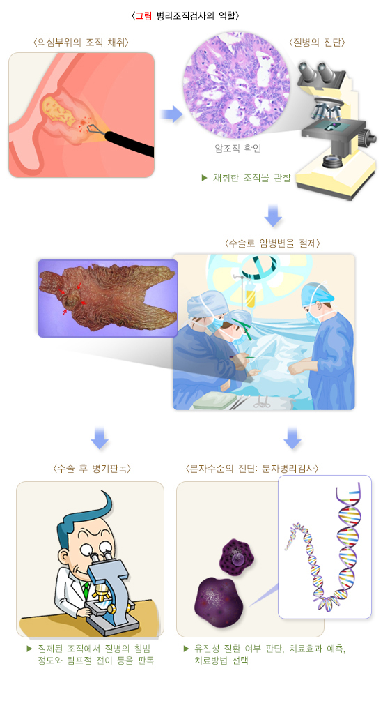  병리조직검사