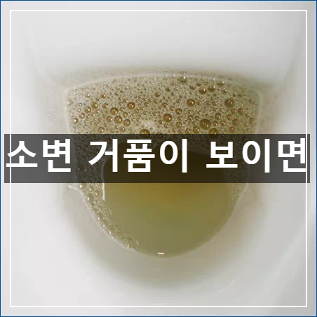 소변 거품