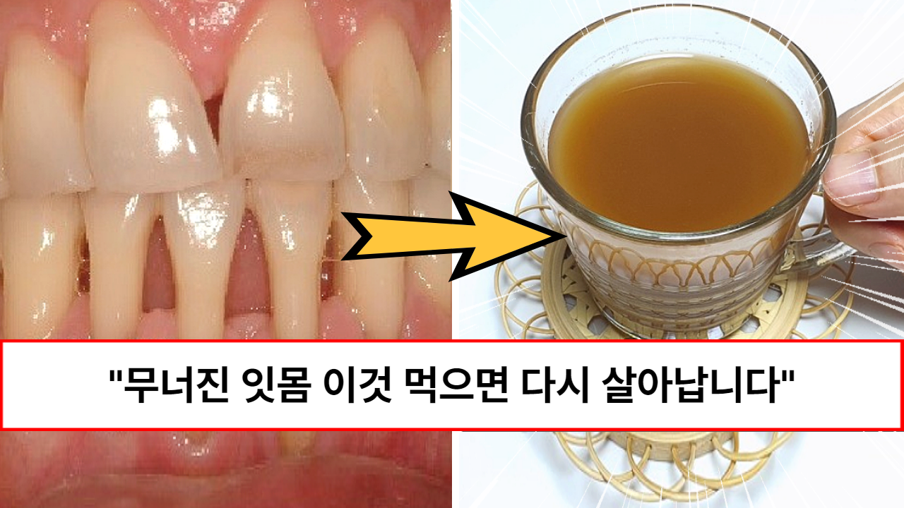 “양치보다 먼저 챙기세요” 쌀쌀한 날씨에 먹기만 해도 잇몸병이 낫고 몸을 따뜻하게 만들어 주는 초간단 면역력 차 “양치보다 먼저 챙기세요” 쌀쌀한 날씨에 먹기만 해도 잇몸병이 낫고 몸을 따뜻하게 만들어 주는 초간단 면역력 차