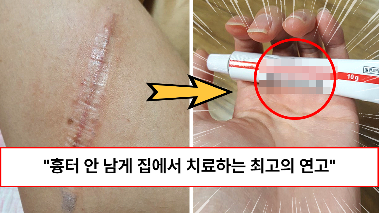 “아무거나 사지 마시고 이거 구입하세요” 아무일도 없었다는 듯 흉없이 새살 돋게 한다는 약국 상처별 흉터 연고