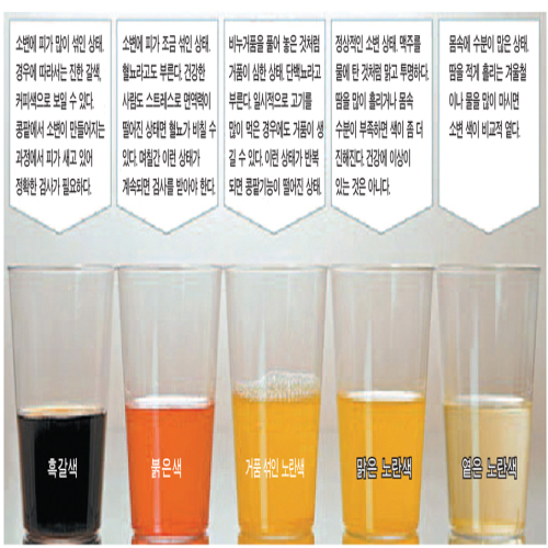  소변이 뿌옇다 탁한 갈색 원인 살펴보자