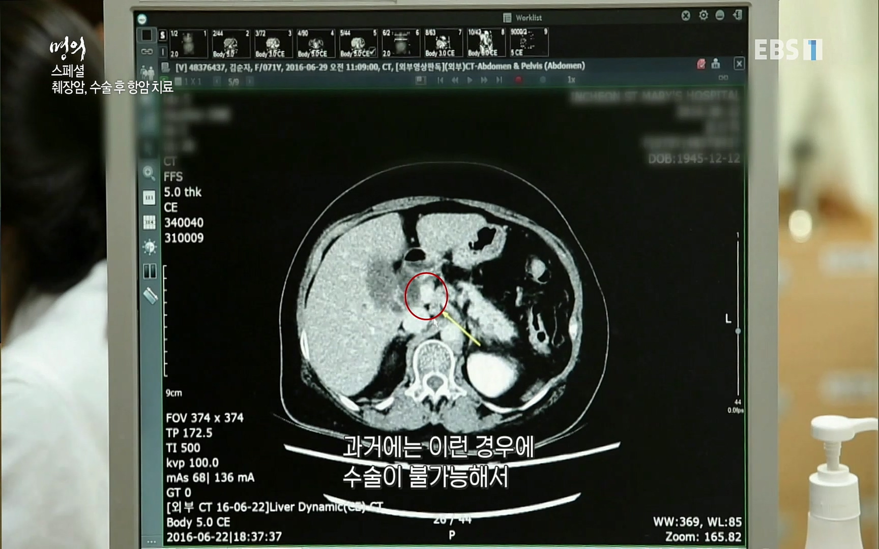 EBS 명의 헬스케어 - TV - 교육의 중심 EBS[명의 스페셜] 공포의 암, 췌장암, 담도암, 담낭암.mp4_20220902_210910.618.jpg