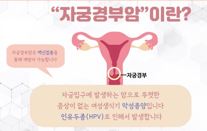 자궁 경부암