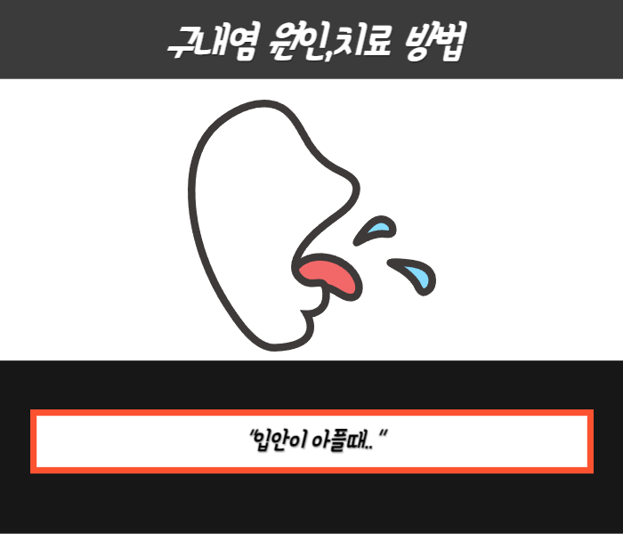 구내염