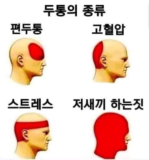  두통의 종류