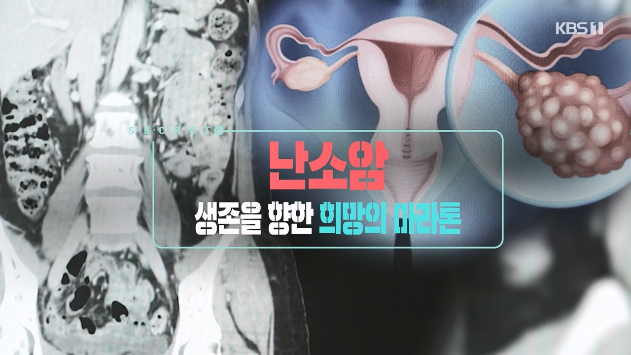 생로병사의 비밀.E878.230803p-NEXT.mp4_20230805_155628.271.jpg