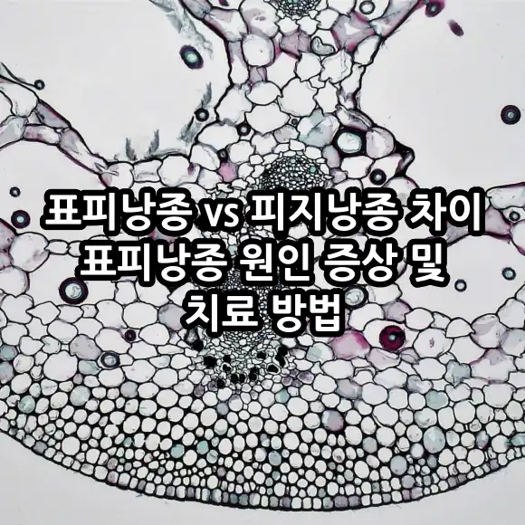 표피낭종 원인 증상 치료 방법