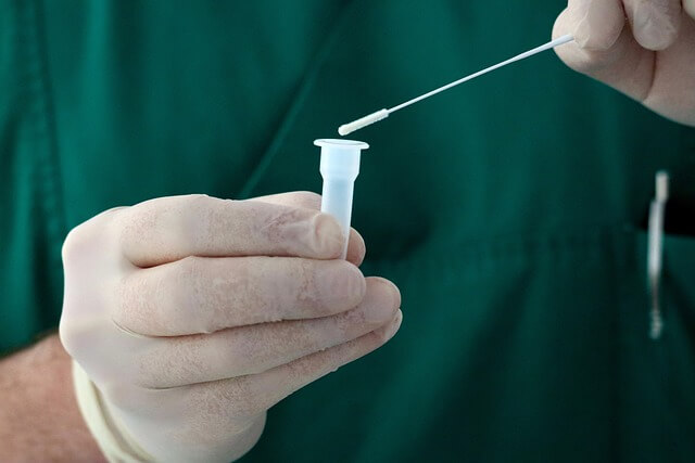 코로나 재유행 확진자 증상, 검사 비용, 격리 기간, 잠복 기간 알아보기