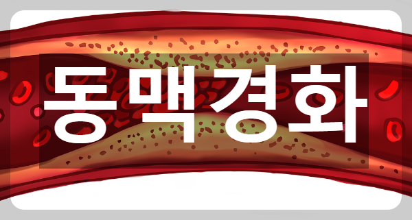  혈관의 비상 신호 동맥경화