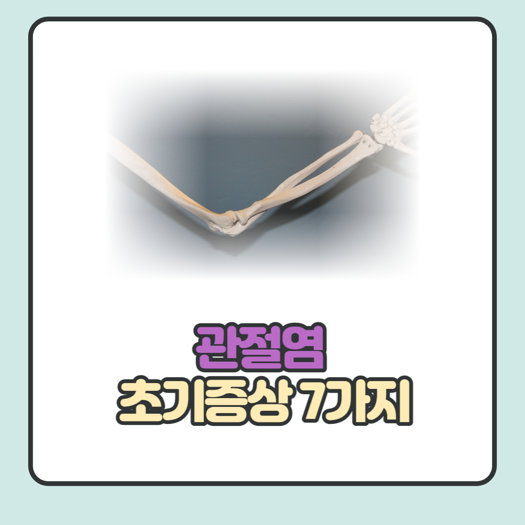  관절염 초기증상 7가지 총 정리