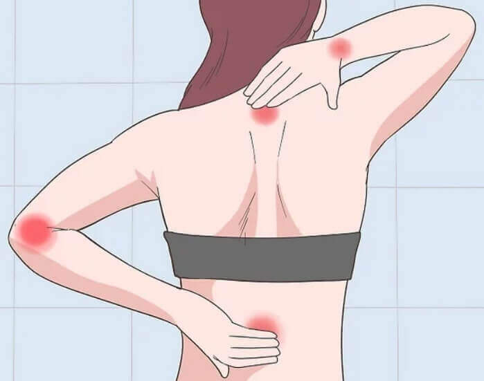  디스크(신경 조임 증상) 증상 완화 시키는 방법