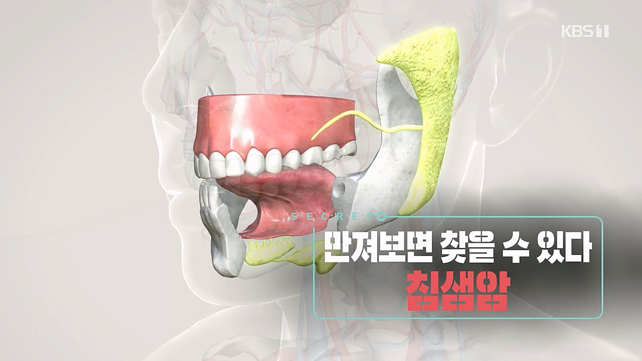 생로병사의 비밀.E851.230112p.H264-F1RST.mp4_20230119_194700.567.jpg