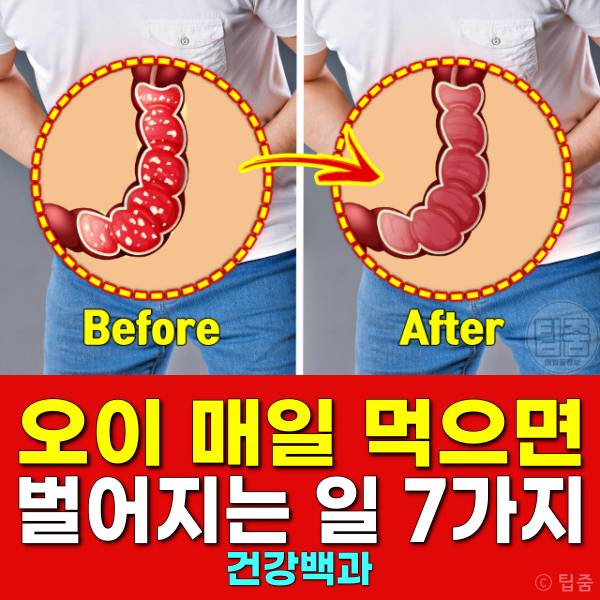 오이 효능 오이 매일 먹으면