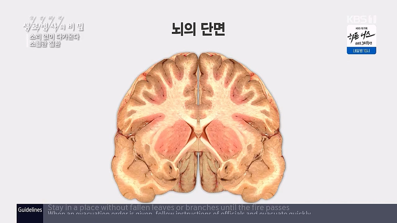 생로병사의비밀.E862.230309p.WANNA.mp4_20230309_194548.856.jpg