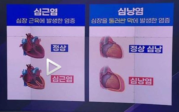 심장초음파 홀터 검사 필수 정보 정리 3