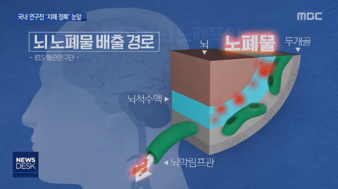  치매 치료와 예방의 새로운 이정표