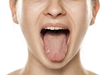 혀통증